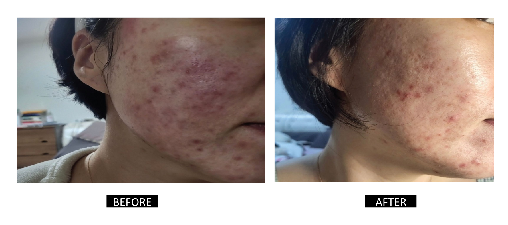 Celigin Timeless Oil Mist